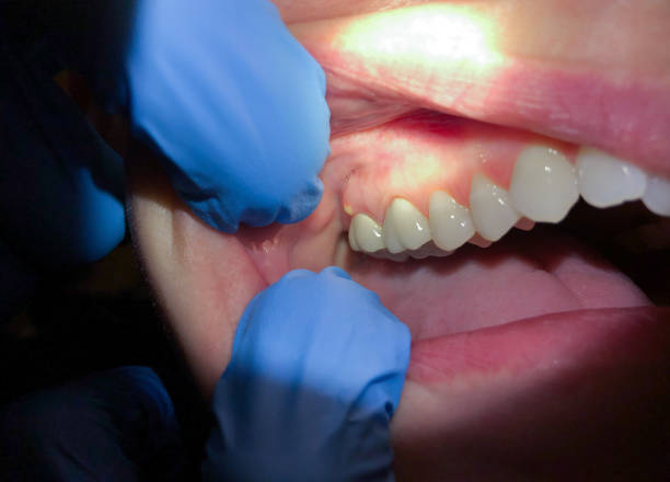Best Emergency Dental Services for Seniors in Hooper, UT